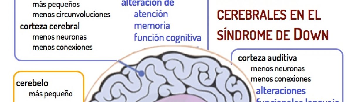 El cerebro del síndrome de Down