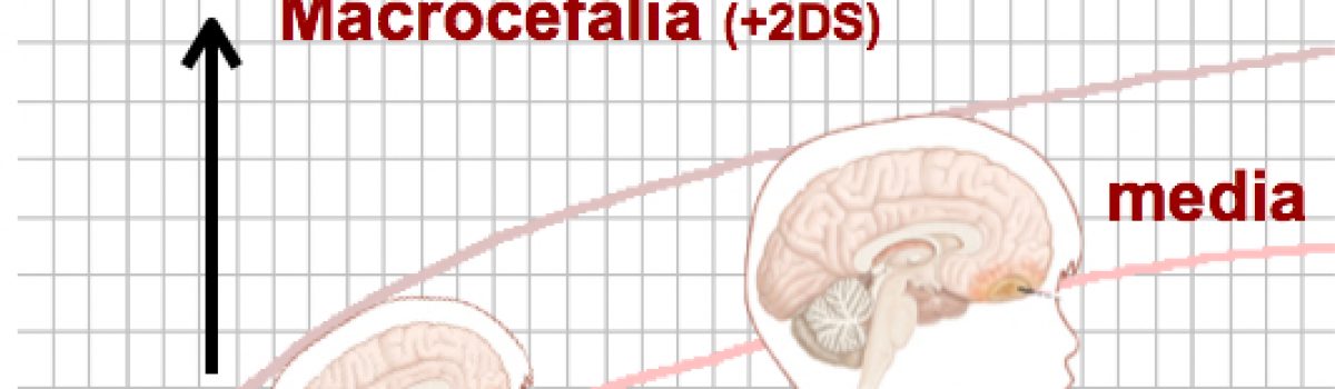 Cuando la cabeza es pequeña: microcefalia