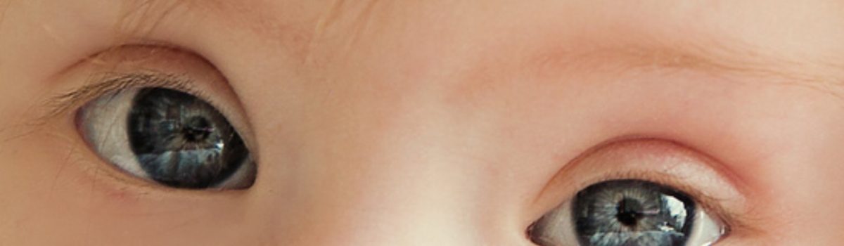 Entrada invitada: Una adorable bebé con síndrome de Down