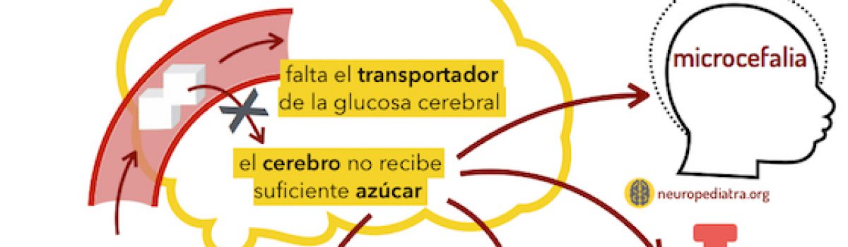 Azúcar para el cerebro – déficit Glut1