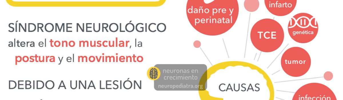 Tratamiento de la parálisis cerebral infantil