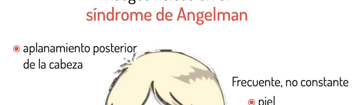 Síndrome de Angelman