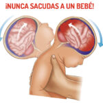 Síndrome del bebé sacudido